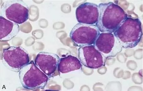 20160122134600 774e1