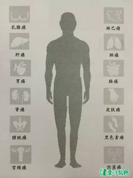 20160321142142 aff0a