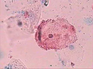 20160414092729 b36f7