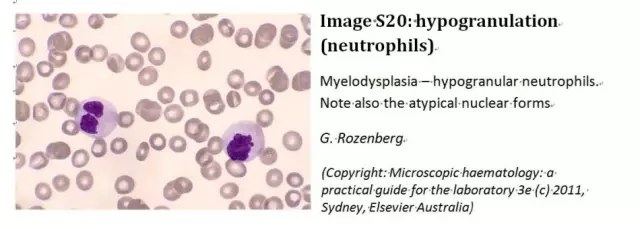 20160512095426 e4aa7