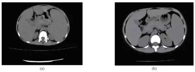 20160608084320 fbaed