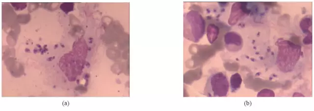 20160608084326 69436