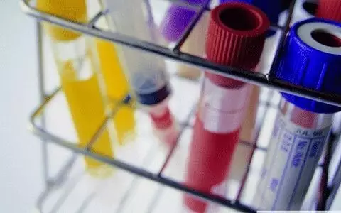 20160617103848 a9e3c