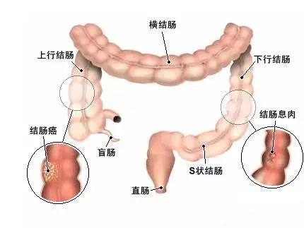 20160809092539 75d04