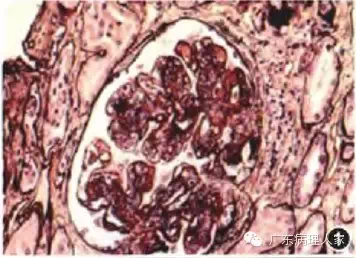 20160817133720 a4fd8