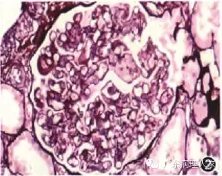 20160817133732 a99eb