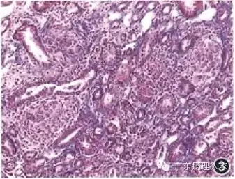 20160817133739 13df7