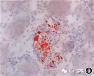 20160817133753 730a3