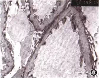 20160817133800 0a561