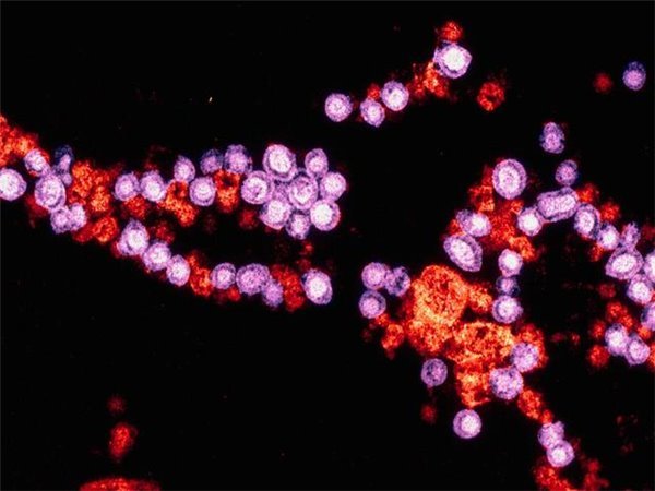 B1451569140 small f80ed